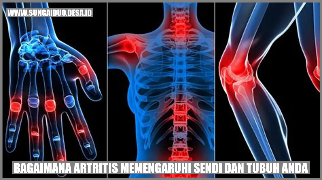 Artritis